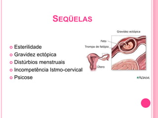 SEQÜELAS
 Esterilidade
 Gravidez ectópica
 Distúrbios menstruais
 Incompetência Istmo-cervical
 Psicose
 