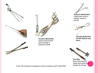 Tesoura embrionária
Usada para cortar a
cabeça, braços e
pernas
Fórceps destrutivo
de Van Huevel com
serra.
Tire-Tete
Esse instrumento é
usado para perfurar a
cabeça da criança.
Tarnier's Basiotribe
Usado basicamente
para esmagar a
cabeça do bebê.
Fonte: http://extestemunhasdejeova.net/forum/viewtopic.php?f=23&t=5509
 