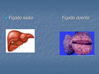 Fígado sadio                     Fígado doente    