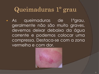 Queimaduras 1º grau
 As queimaduras de 1ºgrau,
geralmente não são muito graves,
devemos deixar debaixo da água
corrente e podemos colocar uma
compressa. Destaca-se com a zona
vermelha e com dor.
22
 