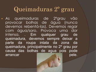 Queimaduras 2º grau
 As queimaduras de 2ºgrau vão
provocar bolhas de água (nunca
devemos rebentá-las). Devemos regar
com água/soro. Provoca uma dor
intensa. . Em qualquer grau de
queimadura, devemos sempre deixar a
parte da roupa intata da zona da
queimadura, principalmente no 2º grau por
causa das bolhas de agua pois pode
arrancar pele.
23
 