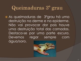 Queimaduras 3º grau
 As queimaduras de 3ºgrau há uma
destruição na derme e na epiderme.
Não vai provocar dor pois houve
uma destruição total das camadas.
Destaca-se por uma parte escura.
Devemos regar sempre com
água/soro.
24
 