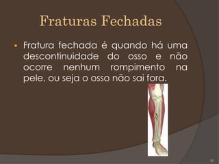Fraturas Fechadas
 Fratura fechada é quando há uma
descontinuidade do osso e não
ocorre nenhum rompimento na
pele, ou seja o osso não sai fora.
28
 