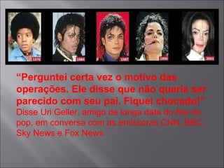 “ Perguntei certa vez o motivo das operações. Ele disse que não queria ser parecido com seu pai. Fiquei chocado!”  Disse Uri Geller, amigo de longa data do Rei do pop, em conversa com as emissoras CNN, BBC, Sky News e Fox News  
