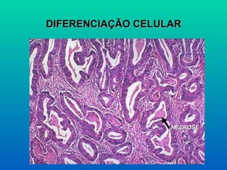DIFERENCIAÇÃO CELULAR NECROSE 