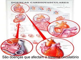 Complicações associadas à Obesidade infantilAs crianças  obesas têm baixa auto estima, muitas vezes dificuldades em relacionarem-se com outras crianças e descriminadas por elas.