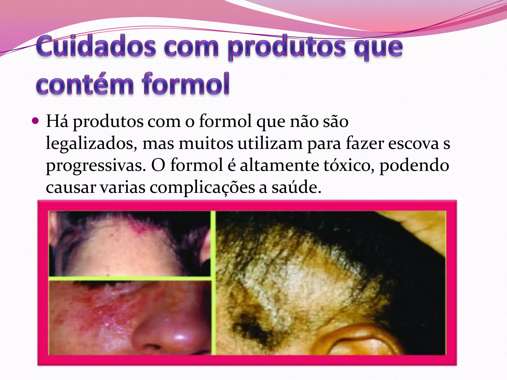  Há produtos com o formol que não são
 legalizados, mas muitos utilizam para fazer escova s
 progressivas. O formol é altamente tóxico, podendo
 causar varias complicações a saúde.
 