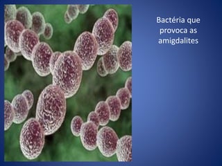 Bactéria que
provoca as
amigdalites
 