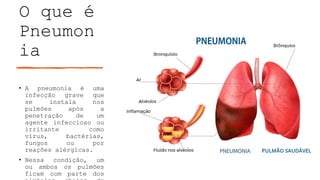 TRABALHO PNEUMONIA Pronto para pequisa ou seminário.pptx