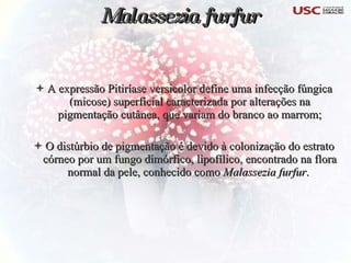 Malassezia furfur A expressão Pitiríase versicolor define uma infecção fúngica (micose) superficial caracterizada por alterações na pigmentação cutânea, que variam do branco ao marrom; O distúrbio de pigmentação é devido à colonização do estrato córneo por um fungo dimórfico, lipofílico, encontrado na flora normal da pele, conhecido como  Malassezia furfur .  