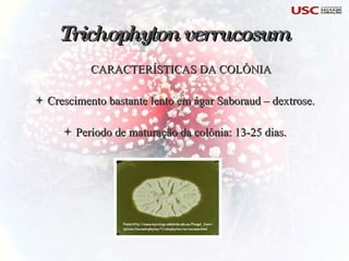 CARACTERÍSTICAS DA COLÔNIA Crescimento bastante lento em ágar Saboraud – dextrose. Período de maturação da colônia: 13-25 dias. Trichophyton verrucosum   