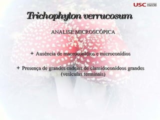ANALISE MICROSCÓPICA Ausência de macroconídios e microconídios Presença de grandes cadeias de clamidoconídeos grandes (vesículas terminais) Trichophyton verrucosum   