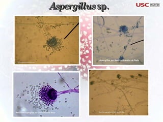 Aspergillus  sp. 