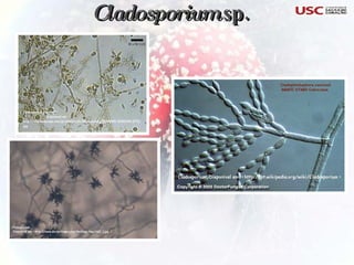 Cladosporium  sp. 