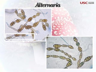 Alternaria Fonte: http://www.mycology.adelaide.edu.au/images/Alternariq.gif 