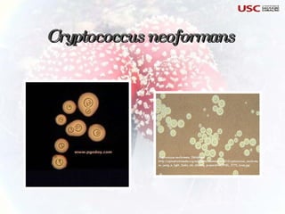 Cryptococcus neoformans 