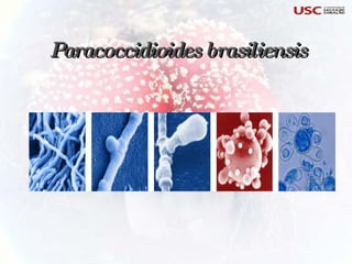 Paracoccidioides brasiliensis 