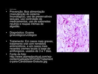 PROFILAXIA: Prevenção: Boa alimentação (manutenção do sistema imunológico), uso de preservativos sexuais, uso controlado de medicamentos, uso de sabonetes neutros e roupas íntimas de algodão.  Diagnóstico: Exame ginecológico/urológico Tratamento: Em casos mais graves, tratamento oral com remédios antimicóticos, e em casos mais recentes cremes locais à base de antifúngicos, usados de 3 a 7 dias. Fonte da foto: http://www.alamedavirtual.com/wp-content/uploads/2010/04/Tratamento-para-Candidiase-Gratuito.jpg 