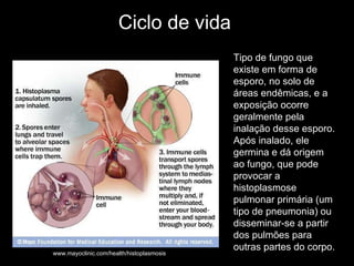 Ciclo de vida Tipo de fungo que existe em forma de esporo, no solo de áreas endêmicas, e a exposição ocorre geralmente pela inalação desse esporo. Após inalado, ele germina e dá origem ao fungo, que pode provocar a histoplasmose pulmonar primária (um tipo de pneumonia) ou disseminar-se a partir dos pulmões para outras partes do corpo.  Tipo de fungo que existe em forma de esporo, no solo de áreas endêmicas, e a exposição ocorre geralmente pela inalação desse esporo. Após inalado, ele germina e dá origem ao fungo, que pode provocar a histoplasmose pulmonar primária (um tipo de pneumonia) ou disseminar-se a partir dos pulmões para outras partes do corpo.  www.mayoclinic.com/health/histoplasmosis 