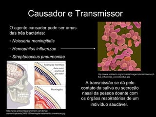Causador e Transmissor O agente causador pode ser umas das três bactérias: Neisseria meningitidis Hemophilus influenzae Streptococcus pneumoniae A transmissão se dá pelo contato da saliva ou secreção nasal da pessoa doente com os órgãos respiratórios de um indivíduo saudável.   http://www.presenteparahomem.com.br/wp-content/uploads/2009/11/meningite-tratamento-prevencao.jpg http://www.sbinfecto.org.br/media/image/noticias/Haemophilus_influenzae_coccobacillus.jpg 