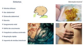 Sintomas
 Vômitos biliosos
 Dor abdominal
 Distensão abdominal
 Diarréia
 Sangramento retal
 Déficit de crescimento
 Frequência cardíaca acelerada
 Respiração rápida
 Isquemia de tecidos intestinais
 