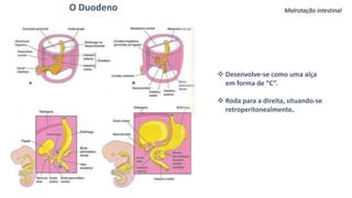 Malrotação intestinalO Duodeno
 Desenvolve-se como uma alça
em forma de “C”.
 Roda para a direita, situando-se
retroperitonealmente.
 