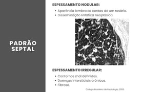 ESPESSAMENTO NODULAR:
Aparência lembra as contas de um rosário.
Disseminação linfática neoplásica.
ESPESSAMENTO IRREGULAR:
Contornos mal definidos.
Doenças intersticiais crônicas.
Fibrose.
Colégio Brasileiro de Radiologia, 2005
 
