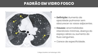 PADRÃO EM VIDRO FOSCO
Definição: Aumento da
opacidade pulmonar sem
obscurecer os vasos adjacentes.
Causas: anormalidades
intersticiais mínimas, doença do
espaço aéreo ou aumento do
fluxo sanguíneo.
Carece de especificidade.
Colégio Brasileiro de Radiologia, 2005
 