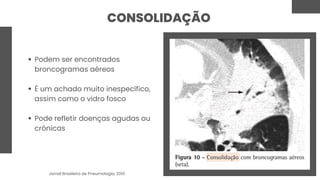 CONSOLIDAÇÃO
Podem ser encontrados
broncogramas aéreos
É um achado muito inespecífico,
assim como o vidro fosco
Pode refletir doenças agudas ou
crônicas
Jornal Brasileiro de Pneumologia, 2010
 
