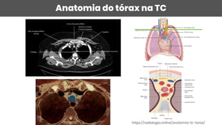 Anatomia do tórax na TC
https://radiologia.online/anatomia-tc-torax/
 