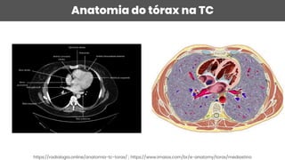 Anatomia do tórax na TC
https://radiologia.online/anatomia-tc-torax/ ; https://www.imaios.com/br/e-anatomy/torax/mediastino
 