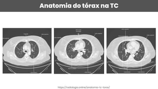Anatomia do tórax na TC
https://radiologia.online/anatomia-tc-torax/
 