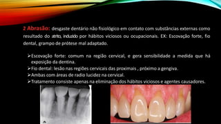 2 Abrasão: desgaste dentário não fisiológico em contato com substâncias externas como
resultado do atrito, induzido por hábitos viciosos ou ocupacionais. EX: Escovação forte, fio
dental, grampo de prótese mal adaptado.
➢Escovação forte: comum na região cervical, e gera sensibilidade a medida que há
exposição da dentina.
➢Fio dental: lesão nas regiões cervicais das proximais , próximo a gengiva.
➢Ambas com áreas de radio lucidez na cervical.
➢Tratamento consiste apenas na eliminação dos hábitos viciosos e agentes causadores.
 