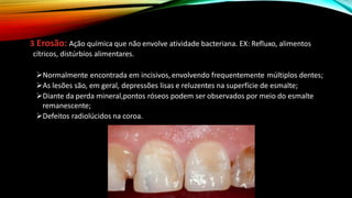 3 Erosão: Ação química que não envolve atividade bacteriana. EX: Refluxo, alimentos
cítricos, distúrbios alimentares.
➢Normalmente encontrada em incisivos,envolvendo frequentemente múltiplos dentes;
➢As lesões são, em geral, depressões lisas e reluzentes na superfície de esmalte;
➢Diante da perda mineral,pontos róseos podem ser observados por meio do esmalte
remanescente;
➢Defeitos radiolúcidos na coroa.
 