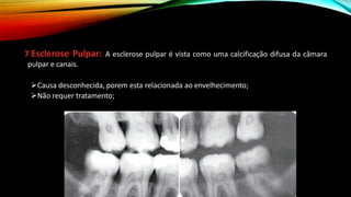 7 Esclerose Pulpar: A esclerose pulpar é vista como uma calcificação difusa da câmara
pulpar e canais.
➢Causa desconhecida, porem esta relacionada ao envelhecimento;
➢Não requer tratamento;
 