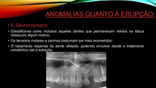 ANOMALIAS QUANTO À ERUPÇÃO:
• 5. Dentes inclusos:
• Classifica-se como inclusos aqueles dentes que permanecem retidos na tábua
óssea por algum motivo;
• Os terceiros molares e caninos costumam ser mais acometidos;
• O tratamento depende do dente afetado, podendo envolver desde o tratamento
ortodôntico até a extração.
 