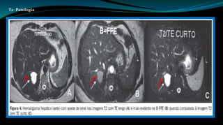 T2- Patologia 
 