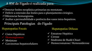 A RM de Fígado é realizada para: 
Detectar lesões neoplásica primarias ou mestatase. 
 Deferir a extensão das lesões para o planejamento cirúrgico. 
Diferenciar hemangioma. 
 Avaliar a permeabilidade e potência dos vasos intra-hepaticos. 
Principais Patologias do Fígado 
Hepatopatias Focais 
 Cistos Hepáticos 
 Hemangiomas 
 Metástase 
 Carcinomas hepatocelulares 
Hepatopatias Difusas 
 Esteatose Hepática 
 Cirrose 
 Síndrome de Budd-Chiari 
 Hemocromatose/ Hemossiderose 
 