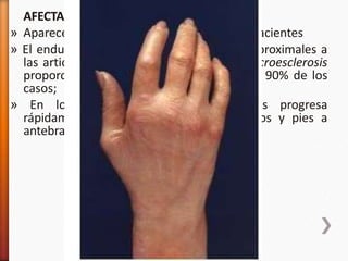 AFECTACIÓN CUTÁNEA.
» Aparece prácticamente en el 100% de los pacientes
» El endurecimiento de la piel en las zonas proximales a
las articulaciones metacarpofalángicas o acroesclerosis
proporciona el diagnóstico definitivo en el 90% de los
casos;
» En los pacientes con formas difusas progresa
rápidamente durante meses, desde manos y pies a
antebrazos, piernas, muslos y tronco.
 