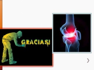 trabalhoreumato-120608020121-phpapp01 (1) (1).pptx