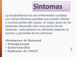 La esclerodermia es una enfermedad compleja
con varios síntomas posibles que pueden afectar
a muchas partes del cuerpo, la mayor parte de los
pacientes desarrolla sólo unos pocos de los
síntomas, cada persona es diferente respecto al
número y gravedad de los síntomas.
•Fenómeno de Raynaud
• Telangiectasia
• Esclerodactilia
• Síndrome de CREST
 