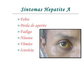 Sintomas Hepatite A Febre Perda de apetite Fadiga  Náusea  Vômito Icterícia 