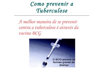 Como prevenir a Tuberculose A melhor maneira de se prevenir contra a tuberculose é através da vacina BCG 