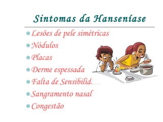 Sintomas da Hanseníase Lesões de pele simétricas Nódulos Placas Derme espessada Falta de Sensibilidade Sangramento nasal Congestão 