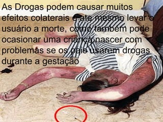As Drogas podem causar muitos efeitos colaterais e ate mesmo levar o usuário a morte, como também pode ocasionar uma criança nascer com problemas se os pais usarem drogas durante a gestação  