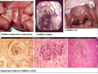 Trabalhos de biologia   dsts (2)