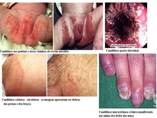 Trabalhos de biologia   dsts (2)