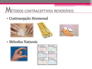MÉTODOS CONTRACEPTIVOS REVERSÍVEIS
• Contracepção Hormonal




• Métodos Naturais
 