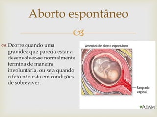 
Aborto espontâneo
 Ocorre quando uma
gravidez que parecia estar a
desenvolver-se normalmente
termina de maneira
involuntária, ou seja quando
o feto não esta em condições
de sobreviver.
 