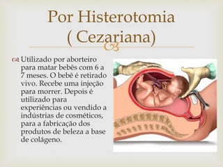 
Por Histerotomia
( Cezariana)
 Utilizado por aborteiro
para matar bebês com 6 a
7 meses. O bebê é retirado
vivo. Recebe uma injeção
para morrer. Depois é
utilizado para
experiências ou vendido a
indústrias de cosméticos,
para a fabricação dos
produtos de beleza a base
de colágeno.
 